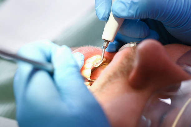 Best Pediatric Emergency Dentist in Sunbury, OH