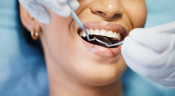 Best Emergency Denture Repair in Sunbury, OH
