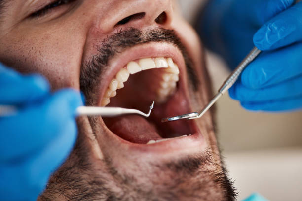 Best Emergency Denture Repair in Sunbury, OH