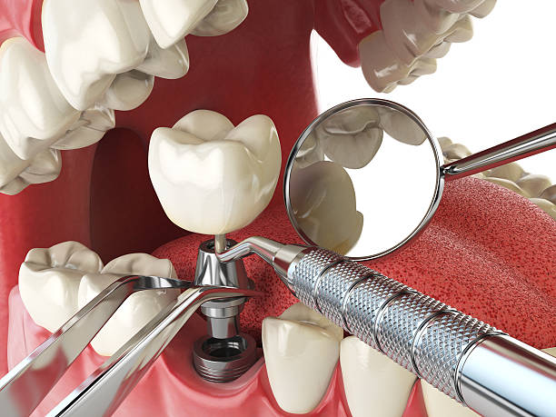Best Emergency Gum Treatment in Sunbury, OH